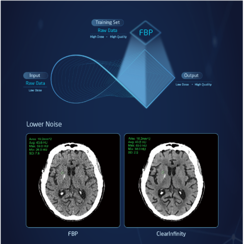 128 Slice CT Scanner